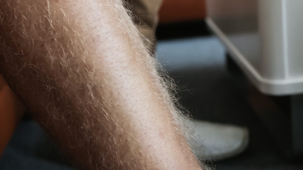 Sugaring: Das Ergebnis